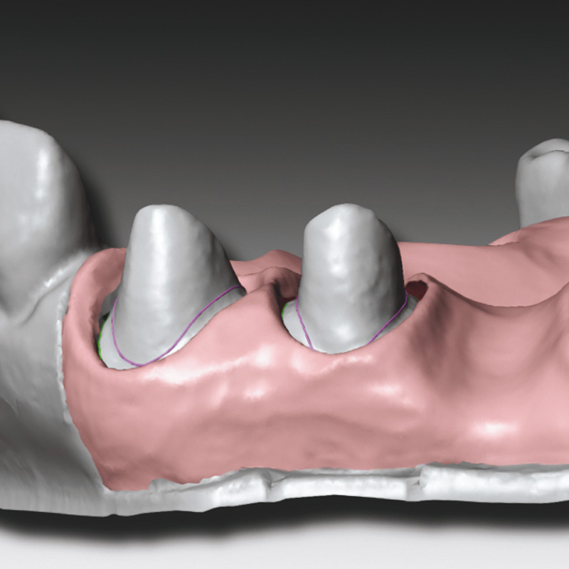 Gingifast CAD Elastic Scan