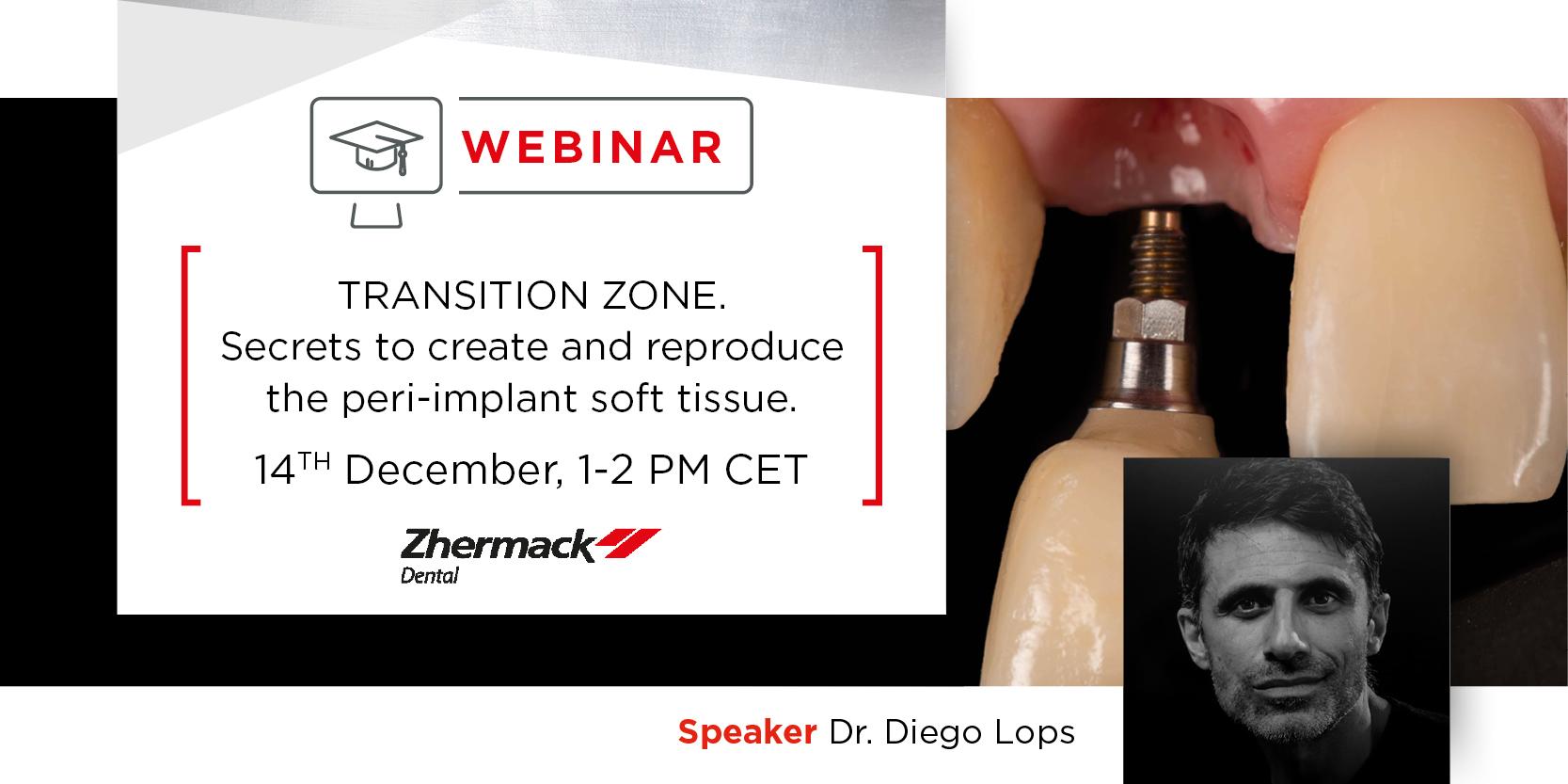 TRANSITION ZONE. Secrets to create and reproduce the peri-implant soft  tissue - Zhermack